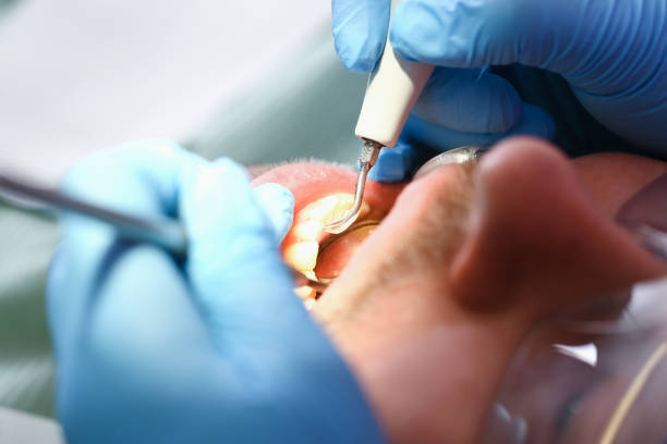 Best Emergency Dentist for Special Needs Patients in Bartlett, IL
